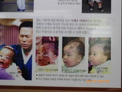 병 고치는 이단 vs 병 못고치는 정통